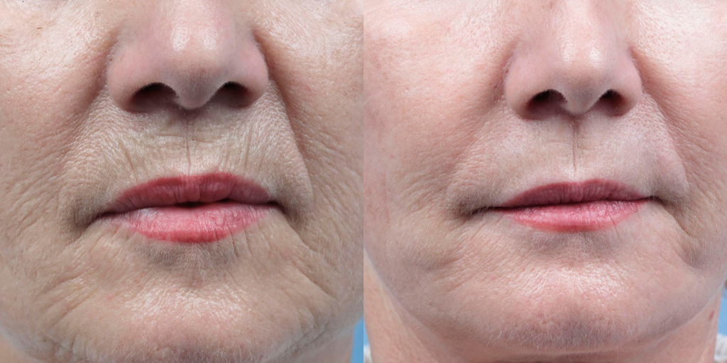 8e5fc245fc0633b061feebd66ee85626